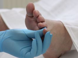 Detail van een nagelbehandeling bij Pedicurepraktijk Margriet in Amersfoort